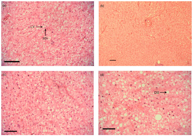 Image for - Effects of Vegetable Oil Source and Dietary Vegetable-fish Oil Ratio on the Histological Alterations of Liver and Intestine of Juvenile Malaysian Mahseer, Tor tambroides