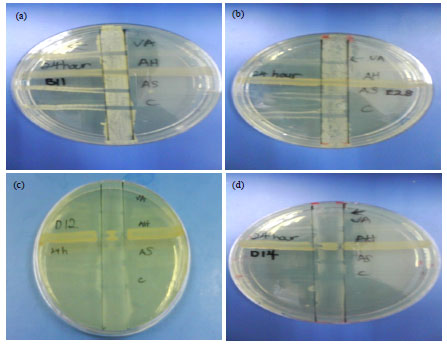 Image for - Antibacterial Ability and Molecular Characterization of Probionts Isolated from Gut Microflora of Cultured Red Tilapia