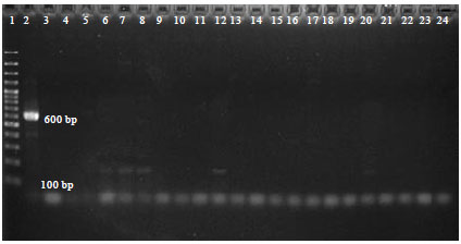 Image for - Polymerase Chain Reaction Detection of Pasteurella multocida Type B:2 in Mice Following Oral Inoculation