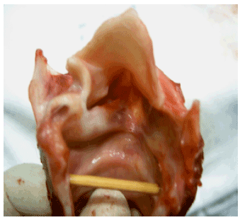 Image for - Range of Vertical Hemilaryngectomy by Diode Laser: An Experimental Study in dogs