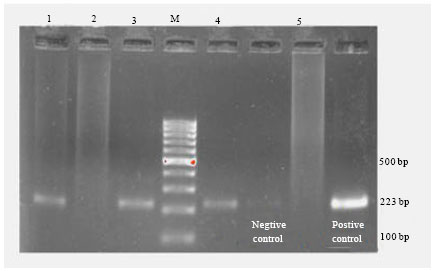 Image for - Serological and Molecular Detection of Brucella abortus  from Cattle by RBPT, STAT and PCR and Sample Suitability of Whole Blood  for PCR