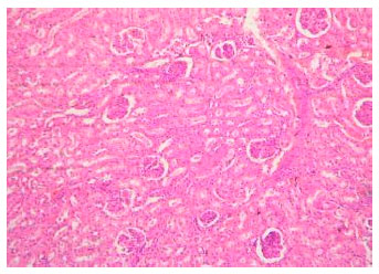Image for - Toxicopathology of Paraquat Herbicide in Female Wistar Rats