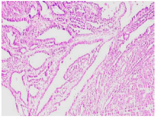 Image for - Histopathology and Immunohistochemical Expression of N-Methyl-N-Nitrosourea (NMU) Induced Mammary Tumours in Sprague-Dawley Rats