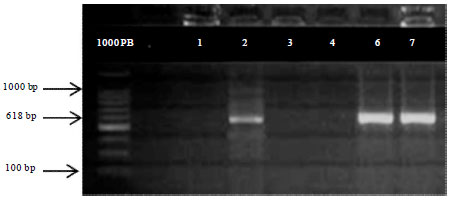 Image for - Detection of Klebsiella pneumoniae, Pseudomonas aeruginosa and ESBL Producing Escherichia coli Associated with Ovarian Hydrobursitis Syndrome in Female Camels (Camelus dromedarus)
