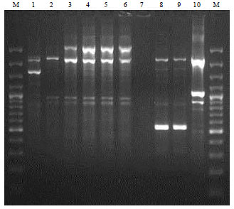 Image for - Molecular Characterization of Arcobacter Isolates Using Randomly  Amplified Polymorphic DNA-Polymerase Chain Reaction (RAPD-PCR)