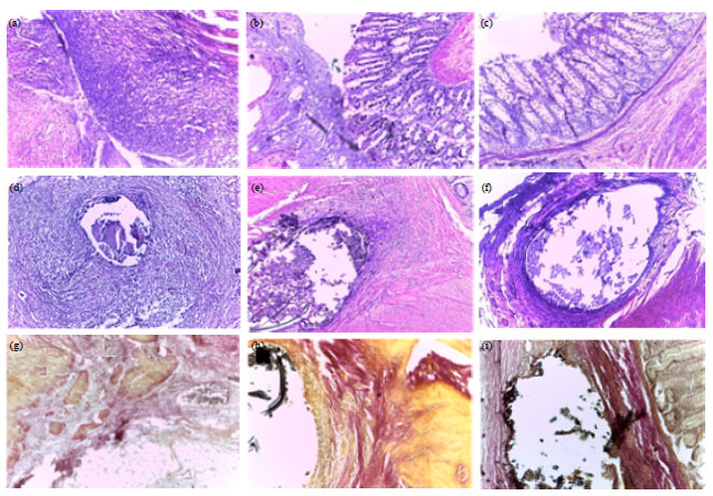 Image for - Surgical and Histopathological Evaluation of Suture Materials for Closure of Colonic Wounds after Experimental Typhlectomy in Dogs