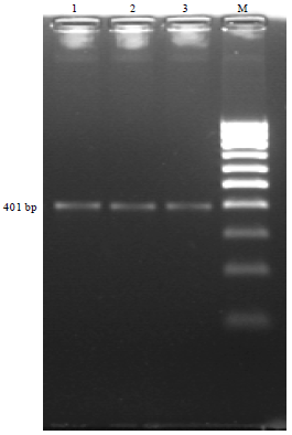 Image for - Comparison of PCR and Conventional Cultural Method for Detection of Salmonella  from Poultry Blood and Faeces
