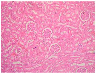 Image for - Toxicopathology of Paraquat Herbicide in Female Wistar Rats