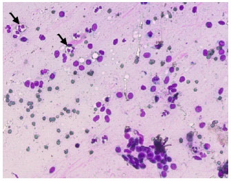 Image for - Histopathological Evaluation of Important Uterine Pathological Affections in Riverine Buffalo (Bubalus bubalis): An Abattoir Study