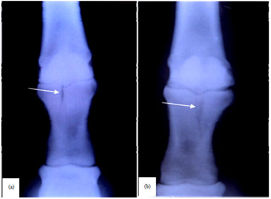 Image for - Impact of Dimethyl Sulfoxide (DMSO) Combined with Corticosteroid on Repair of Fractures of the Proximal Phalanx in 14 Horses