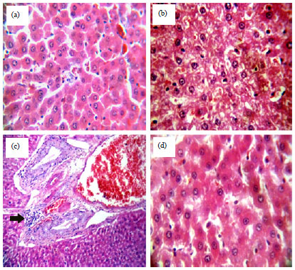 Image for - Protective Role of Wheat Germ Oil against Hyperglycemia and Hyperlipidemia in Streptozotocin Induced Diabetic Rats