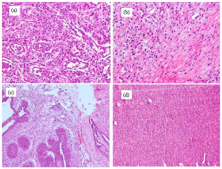 Image for - Sequence Characterization of Baculoviral Inhibitor of Apoptosis Repeat Containing 5 (BIRC 5) Gene from a Case of Canine Mammary Tumour