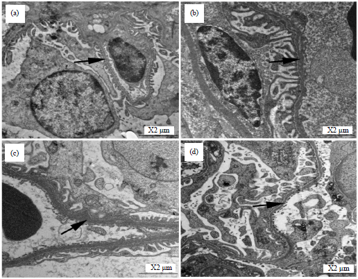 Image for - Effects of UVC Radiation on the Thickness of Glomerular Basement Membrane in Mole Rats