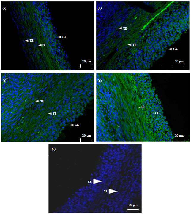 Image for - Expression and Localization of Fibroblast Growth Factor 10 (FGF10) in Ovarian Follicle During Different Stages Development in Buffalo