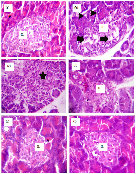 Image for - Protective Role of Wheat Germ Oil against Hyperglycemia and Hyperlipidemia in Streptozotocin Induced Diabetic Rats
