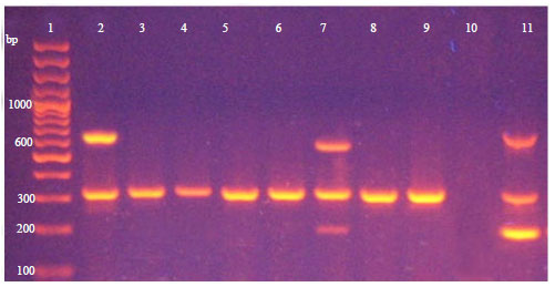 Image for - Multiplex PCR and Detection of netB gene of Clostridiumperfringens from Broilers with Necrotic Enteritis