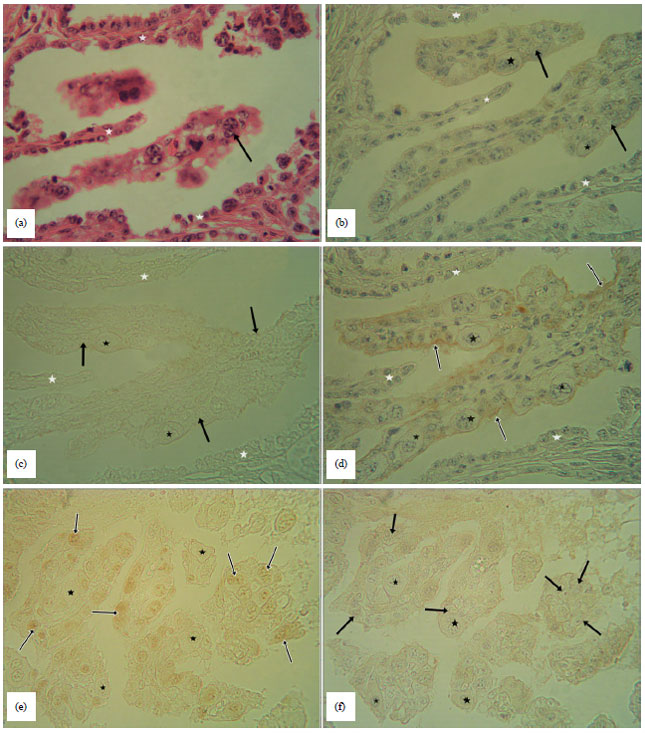 Image for - Mitotic Autocrine and Paracrine Roles of Gastrin-releasingPeptide (GRP) in the Placental Tissues of Seven Months PregnantCows