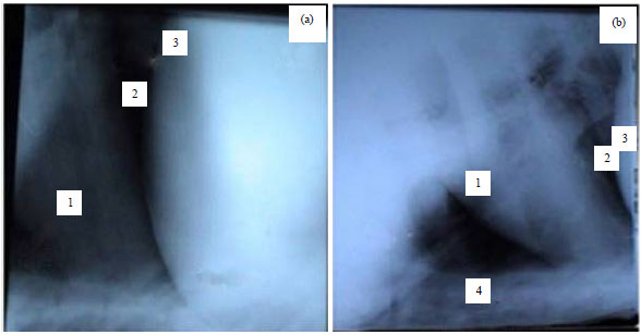 Image for - Diagnostic Significance of Ultrasonography in Complicated Traumatic Reticuloperitonitis in Egyptian Buffaloes (Bubalus bubalis)