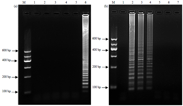 Image for - Rapid and Sensitive Detection of Schmallenberg Virus by a One-step Reverse Transcription Loop-mediated Isothermal Amplification Method