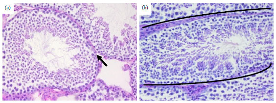 Image for - Testicular Morphometry and Histology of Rabbit Bucks Supplemented with Iodine in Drinking Water