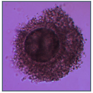 Image for - Supplementation of Leptin on in vitro Maturation of Sheep Oocytes