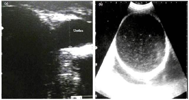 Image for - Transcutaneous and Transrectal Ultrasonography in Buffalo Calves with Urine Retention
