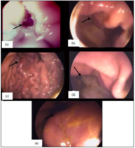 Image for - Evaluation of Experimental Gastric Endoscopic Mucosal Resection (EMR) in Dogs
