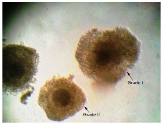 Image for - Effect of Cryoprotective Solutions, Ethylene Glycol, Dimethyle-sulfoxide and Ficoll 70 with Different Combination Ratios on Vitrification of Bovine Oocytes and Embryos Produced in vitro
