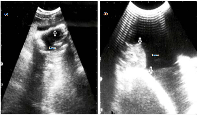 Image for - Transcutaneous and Transrectal Ultrasonography in Buffalo Calves with Urine Retention