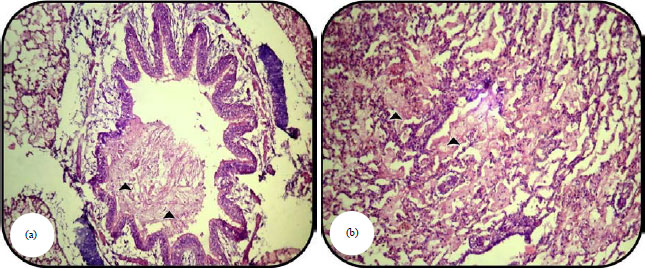 Image for - Diagnosis of Pneumonic Pasteurellosis in Buffalo Calves withReference to the Role of Vitamin D