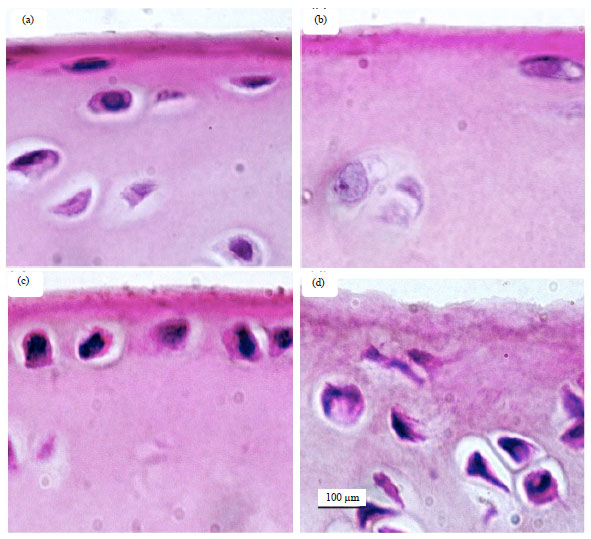 Image for - Therapeutic Benefit of Intra-articular Administration of Deciduous Teeth Stem Cells in Rabbit Model of Osteoarthritis