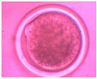 Image for - Supplementation of Leptin on in vitro Maturation of Sheep Oocytes