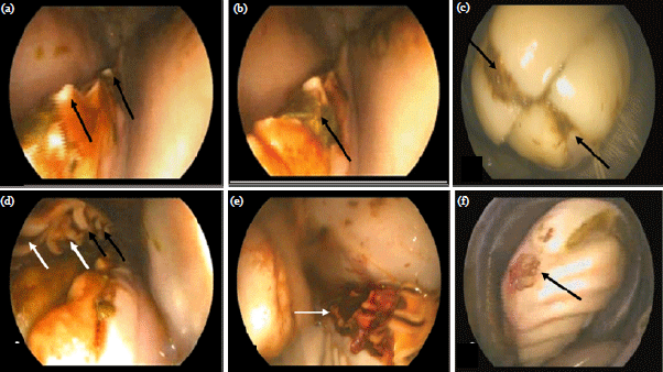Image for - Endoscopic Diagnosis of Some Oro-dental Disorders in Donkeys (Equus asinus)