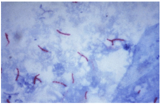Image for - Tuberculosis in Animals and Humans: Evolution of Diagnostics and Therapy
