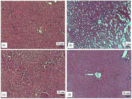 Image for - Effects of Ghrelin on Inflammation and Oxidative Stress Parameters in Sepsis-induced Liver Tissue of Rat
