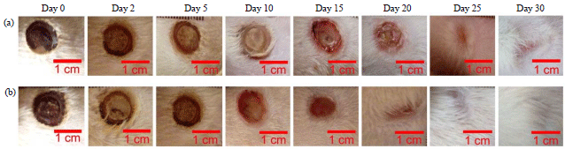 Image for - Mesenchymal Stem Cell-conditioned Medium Promote theRecovery of Skin Burn Wound