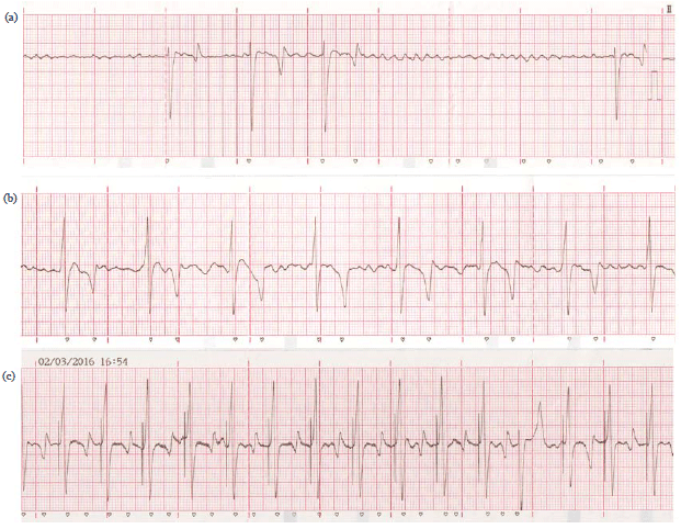 Image for - Pacemaker Implantation in Horse with Bradycardia-Tachycardia Syndrome