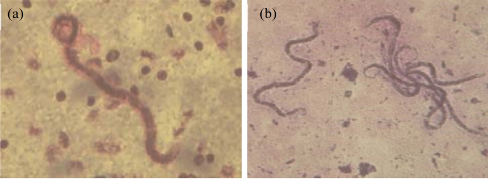 Image for - Molecular Evidence of Filariasis Transmission Through Cats and Dogs in West Sumatra