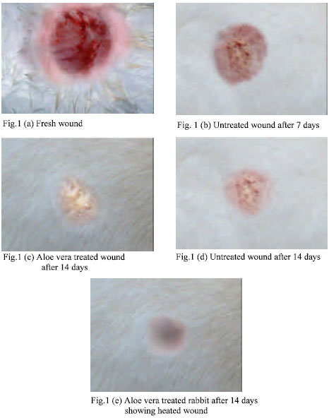 Image for - Wound Healing Potential of Aloe vera Leaf Gel Studied in Experimental Rabbits