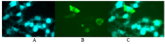 Image for - Cloning and Identification of a Novel Human Gene hSVOP Similar to Synaptic Vesicle Protein