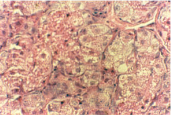 Image for - Treatment of Streptozotocine Induced Diabetes Mellitus in Male Rats by Immunoisolated Transplantation of Purified Langerhans Islet Cells