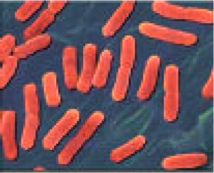 Image for - Electrical Field Modelling of E. coli Bacteria