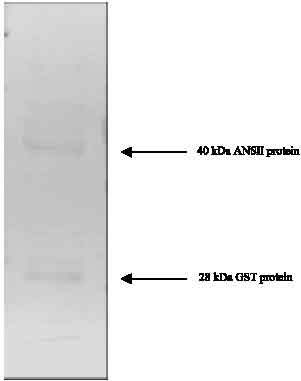 Image for - Cloning, Purification, Characterization and Immobilization of L-asparaginase II from E. coli W3110