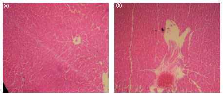 Image for - Biochemical and Histological Changes Associated with Long Term Consumption of Gnetum africanum Welw. Leaves in Rats
