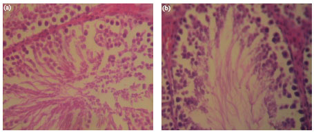 Image for - Biochemical and Histological Changes Associated with Long Term Consumption of Gnetum africanum Welw. Leaves in Rats