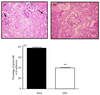 Image for - Reno-protective Effects of Eicosapentaenoic Acid (EPA) Against PAN Induced Nephrosis in WKY Rats