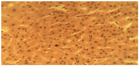 Image for - Liver Protective Activity of the Methanol Extract of Crinum jagus Bulb against Acetaminophen-induced Hepatic Damage in Wistar Rats