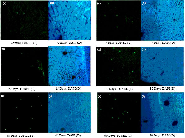 Image for - Oxidative Damage of Liver, Kidney and Serum Proteins with Apoptosis of above Tissues in Guinea Pigs Fed on Carbonated Soft Drink