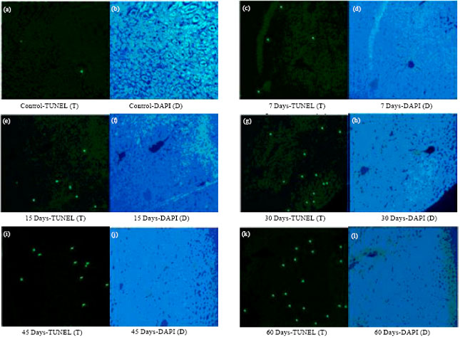 Image for - Oxidative Damage of Liver, Kidney and Serum Proteins with Apoptosis of above Tissues in Guinea Pigs Fed on Carbonated Soft Drink