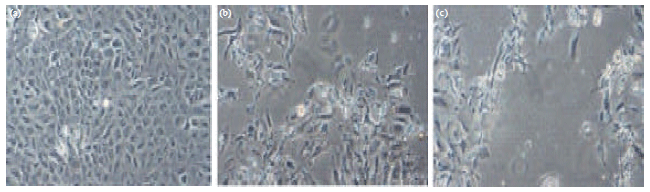 Image for - In vitro Anticancer Effect of Acanthus ilicifolius on Hepatocellular Carcinoma Cells